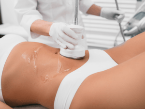 Formation en ligne lipocavitation radiofrequence