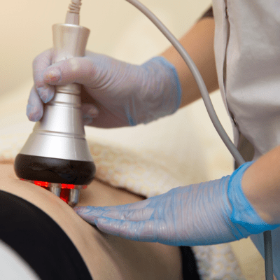 Formation en ligne lipocavitation radiofrequence