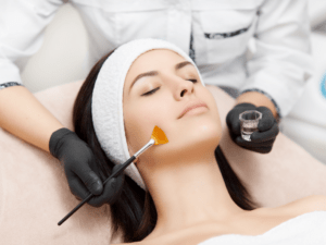 Formation en ligne peeling chimique