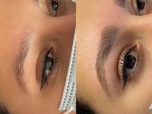 Formation en ligne browlift