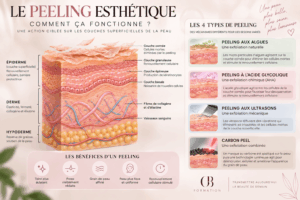 peeling esthétique